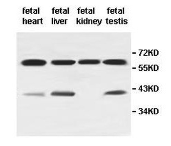 AGTR2 Rabbit Polyclonal Antibody