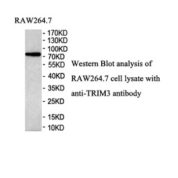 TRIM3 Rabbit Polyclonal Antibody