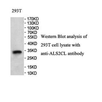 ALS2CL Rabbit Polyclonal Antibody