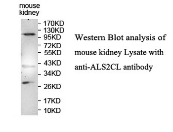 ALS2CL Rabbit Polyclonal Antibody