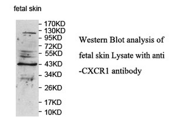 CXCR1 Rabbit Polyclonal Antibody