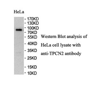 TPCN2 Rabbit Polyclonal Antibody