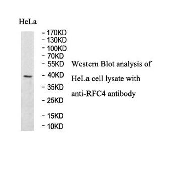 RFC4 Rabbit Polyclonal Antibody