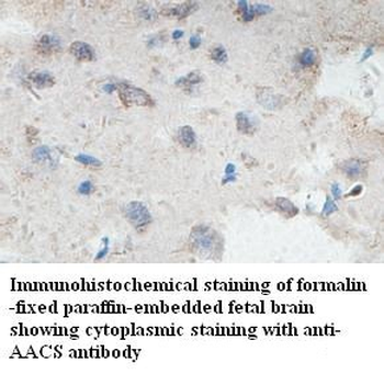 AACS Rabbit Polyclonal Antibody