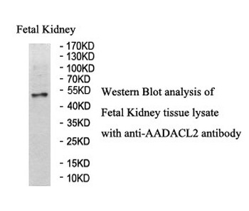 AADACL2 Rabbit Polyclonal Antibody