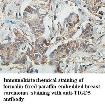 TIGD5 Rabbit Polyclonal Antibody