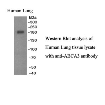 ABCA3 Rabbit Polyclonal Antibody