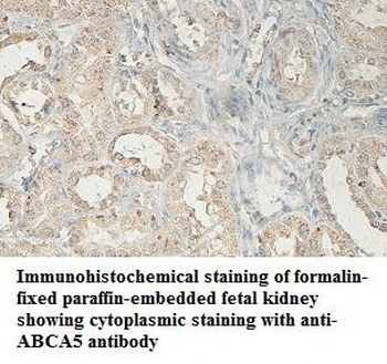 ABCA5 Rabbit Polyclonal Antibody