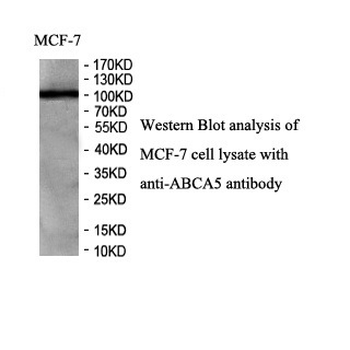 ABCA5 Rabbit Polyclonal Antibody