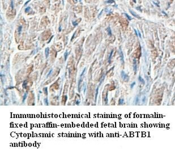 ABTB1 Rabbit Polyclonal Antibody