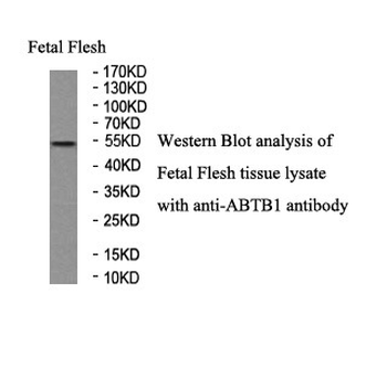 ABTB1 Rabbit Polyclonal Antibody
