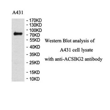 ACSBG2 Rabbit Polyclonal Antibody