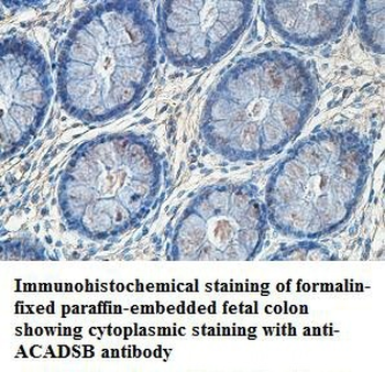 ACADSB Rabbit Polyclonal Antibody