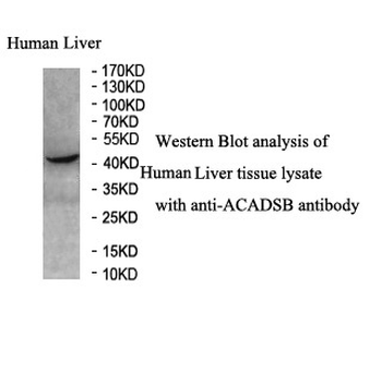 ACADSB Rabbit Polyclonal Antibody