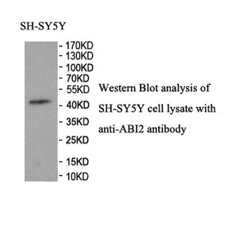 ABI2 Rabbit Polyclonal Antibody