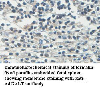 A4GALT Rabbit Polyclonal Antibody