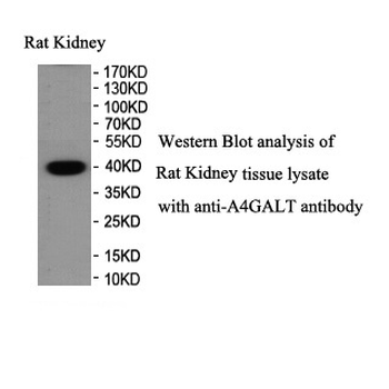 A4GALT Rabbit Polyclonal Antibody