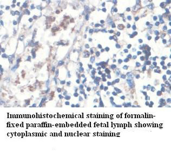 ZAK Rabbit Polyclonal Antibody