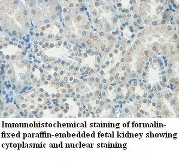 HHLA3 Rabbit Polyclonal Antibody
