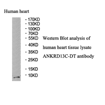 HHLA3 Rabbit Polyclonal Antibody
