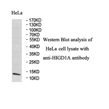 HIGD1A Rabbit Polyclonal Antibody