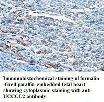 UGCGL2 Rabbit Polyclonal Antibody