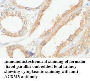 ACSM3 Rabbit Polyclonal Antibody