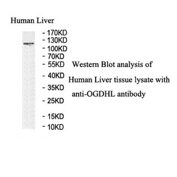 OGDHL Rabbit Polyclonal Antibody