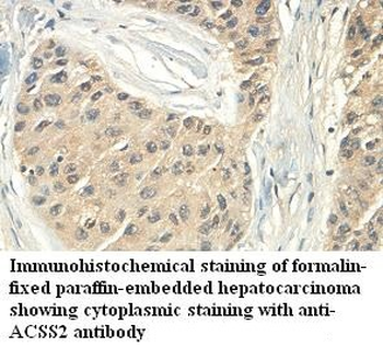 ACSS2 Rabbit Polyclonal Antibody