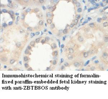 ZBTB8OS Rabbit Polyclonal Antibody