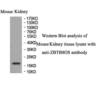 ZBTB8OS Rabbit Polyclonal Antibody