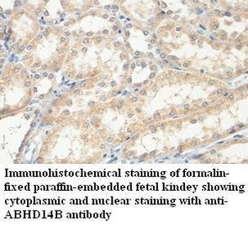 ABHD14B Rabbit Polyclonal Antibody