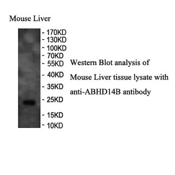 ABHD14B Rabbit Polyclonal Antibody