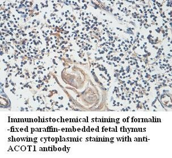 ACOT1 Rabbit Polyclonal Antibody