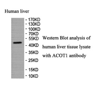 ACOT1 Rabbit Polyclonal Antibody