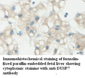 DUSP7 Rabbit Polyclonal Antibody