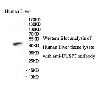 DUSP7 Rabbit Polyclonal Antibody