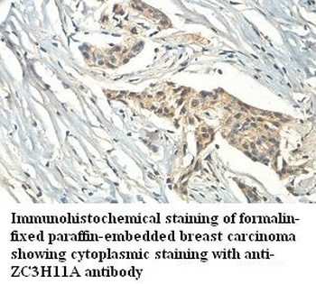 ZC3H11A Rabbit Polyclonal Antibody