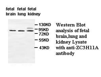 ZC3H11A Rabbit Polyclonal Antibody