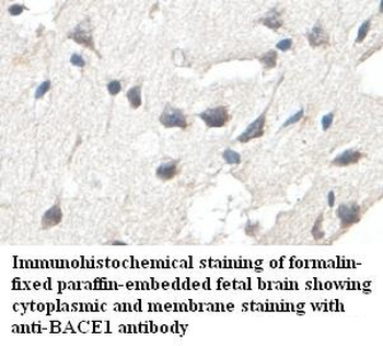 BACE1 Rabbit Polyclonal Antibody