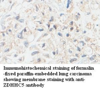 ZBTB26 Rabbit Polyclonal Antibody