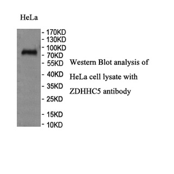 ZBTB26 Rabbit Polyclonal Antibody