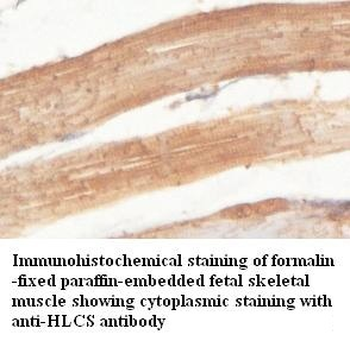 HLCS Rabbit Polyclonal Antibody