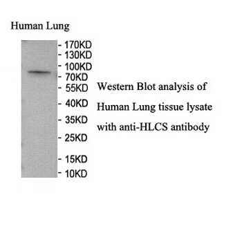 HLCS Rabbit Polyclonal Antibody
