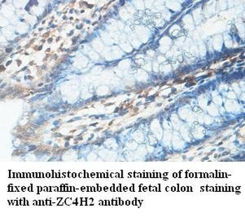 ZC4H2 Rabbit Polyclonal Antibody