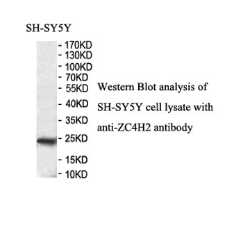 ZC4H2 Rabbit Polyclonal Antibody