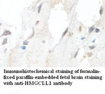 HMGCLL1 Rabbit Polyclonal Antibody