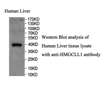 HMGCLL1 Rabbit Polyclonal Antibody