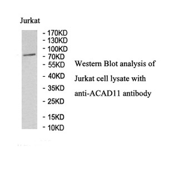 ACAD11 Rabbit Polyclonal Antibody