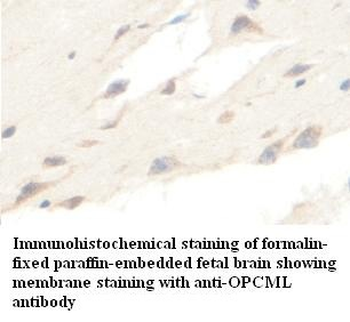 OPCML Rabbit Polyclonal Antibody